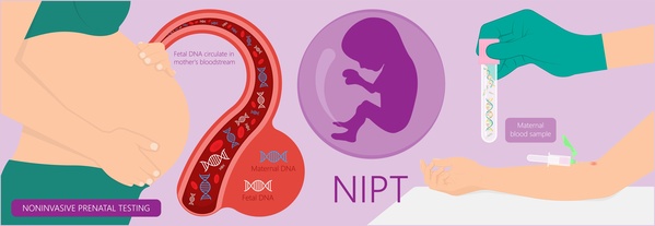 新型出生前診断（NIPT)