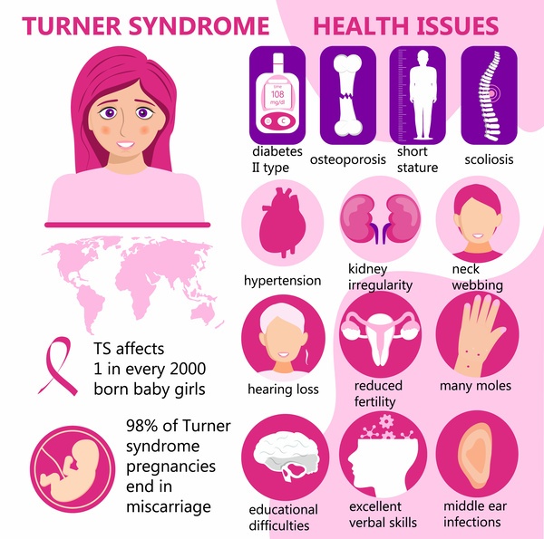 ターナー症候群の特徴